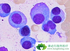 �෢�Թ������ּ��֣���ͬ���͵Ķ෢�Թ�����֢״��������