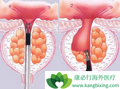 �԰���ҩ������/������������ǰ���ٰ��ܻ���