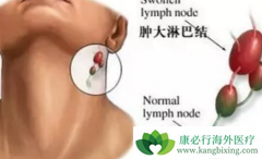 �ܰͰ���֢״����Щ��Ҫ������������