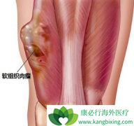 ��������������ת���Է�֬��������֯��������ѡ��