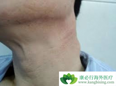 �й��ܰͰ����Ʒ�������Щ�����߲ο�