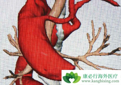 �����鵥��¡����/̩���������ͬ��������ǿ��������Ч��