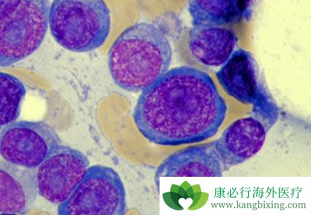 多发骨髓瘤 多发骨髓瘤