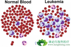 ��Ѫ���Ŵ��𣿳����Ŵ�������Щ���ػ��շ���Ѫ����