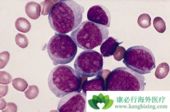 ��Щ֢״�ǰ�Ѫ��ǰ�ף���Ѫ����Σ��Ⱥ����Щ��