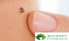 ����ҽ�Ƹ����������ʼ��ߵĺ�ɫ������֢״����Щ��