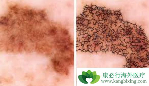 ��ɫ�������������