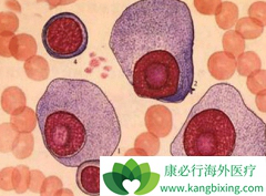 ��֢��ҩ���ǶȰ����������ڹ��谩������Ч����ô����