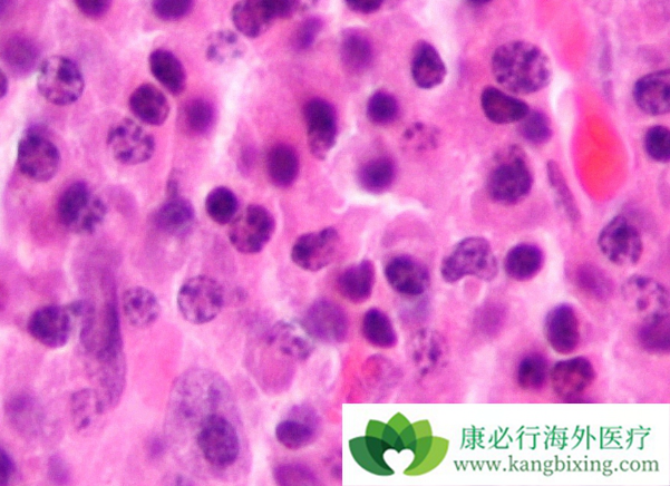 �������ܻ���