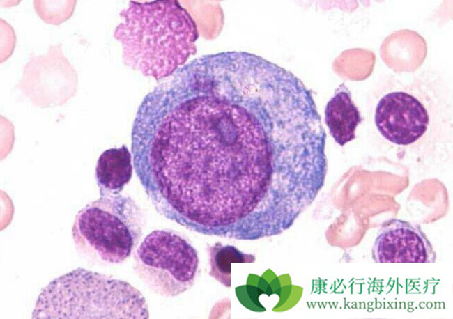 ���������쳣�ۺ���