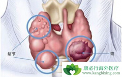 ��״�ٰ������ܻ��ã��������Ԥ����״�ٰ�������