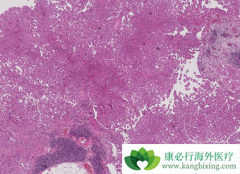 ʲô�Ƕ��Լ�Ƥ����Ŀǰ���ƶ��Լ�Ƥ���ķ�������Щ��