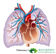 ʲô�Ƿζ�����ѹ���ٴ��Ϸζ�����ѹ֢״����Щ��