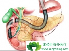 Ϊ���������ٰ�Ч�����Щ�����׻����ٰ�