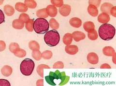 ��Ѫ�������в�����Ⱦ����Ҫ������