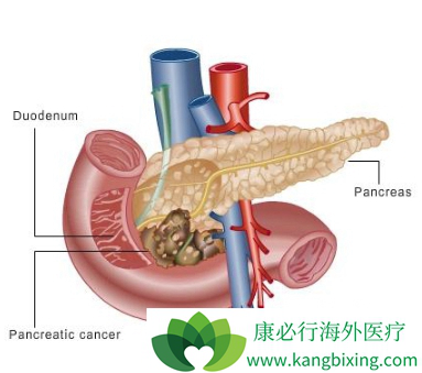 �������ٰ�