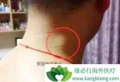 �˽��ܰͰ�֢״����������а���