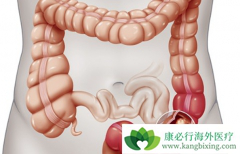 ����ֱ����֢״�����������ᱻ���ߺ���