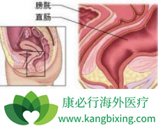 ֱ����֢״�����ڻ���ִ���Ѫ����