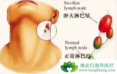 ���ڱ��ʰ�֢״�����ر����ױ����ߺ���