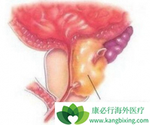 ͨ���˽�ǰ���ٰ�֢״�����ͻ�������