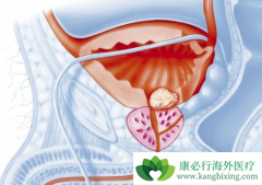 ǰ���ٰ��ܻ���ȡ�����Ƿ������Ч����