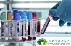 ����ҽ����Ѫ�켼����ǰ����Ԥ֪���༲��