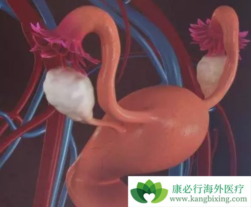 子宫癌症状 子宫癌症状