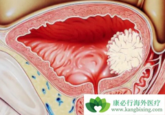 ���װ�����ʱ���װ�֢״����Щ