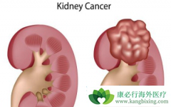 ����֢״�����ڷ����ڻ������Щ����