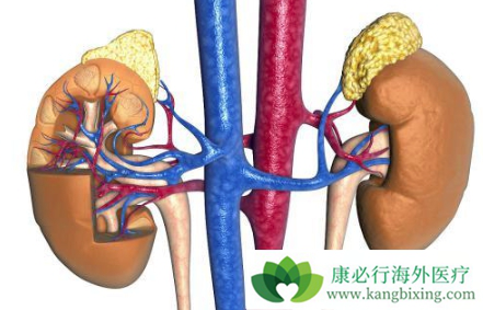 肾癌症状 肾癌症状
