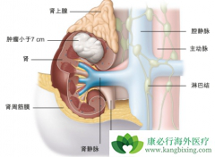 ������Щ����֢״Ϊʲô���ױ����ߺ���