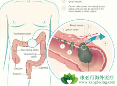 �󳦰�֢״��������Щ���棿�󳦰��ᷢ����Щ�ź�