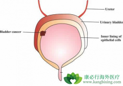��Ī¬����(Cyramza)����������·��Ƥ������Ч������PD-1�����Ʒ�