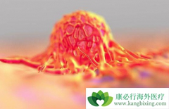 ��֢�����ܻ����ǰ�֢���߱ȽϹ�ע������