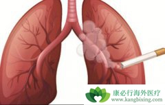 ʲô�Ƿ�Сϸ���ΰ������Сϸ���ΰ���������ص���������Щ��