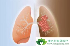 �ΰ�����ʳ�Ի��⻯��ҩ��Ķ�����Ӧʮ����Ч