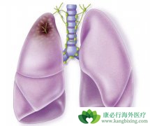 �ΰ���ת��֢״����Щ����ʲô�����������ƣ�