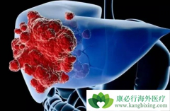 ������(REGORAFENIB)/��������Ч�ӳ�θ�ٰ����ߵ�PFS