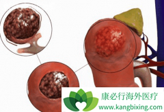 ��̹/��������������ӳ�������������DFS����λ����ʱ��