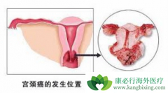 ���ڹ��������߿��Բ���PD-1���Ƽ�Keytruda������