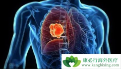 PD-1���Ƽ���Ȭ��(pembrolizumab)����������Էΰ��ķ�Ӧ��