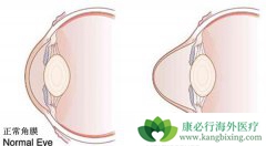 ����ҽ�������������ĳ��ִ���Բ׶��Ĥ��������