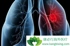 �ΰ�����֢״������Щ֢״�Ƿǳ�������