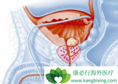 ���ð�������(XBIRA)��ǰ���ٰ������������ǰ�ο����2��