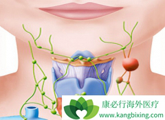 ���ǶȰ�(Revlimid)/��������Ч��������DLBCL���ߵ�PFS