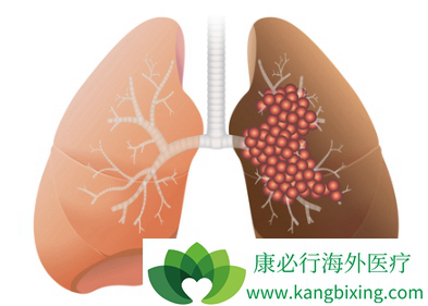 �ΰ����ڻ��ܻ���