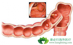 ����������������������������ֱ��������Ч����ô��