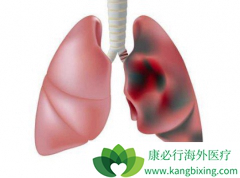 �ΰ�����֢״�������Щ�û��ߵ��ĵ����