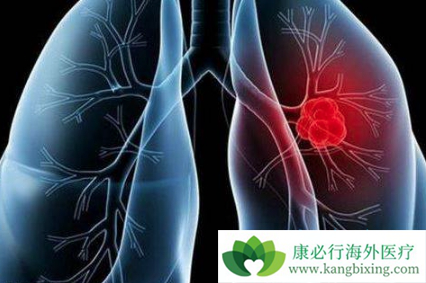 �ΰ����ڵ�֢״